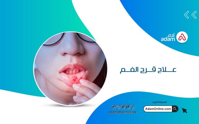 علاج قرح الفم