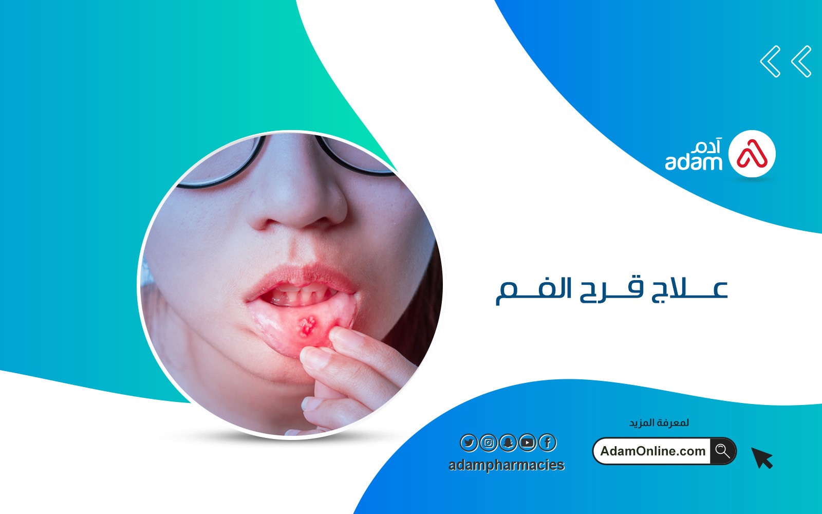 علاج قرح الفم